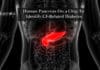 Human Pancreas On a Chip To Identify CF-Related Diabetes