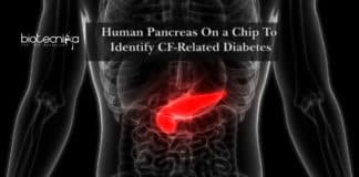 Human Pancreas On a Chip To Identify CF-Related Diabetes