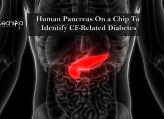 Human Pancreas On a Chip To Identify CF-Related Diabetes Human Pancreas On a Chip To Identify CF-Related Diabetes