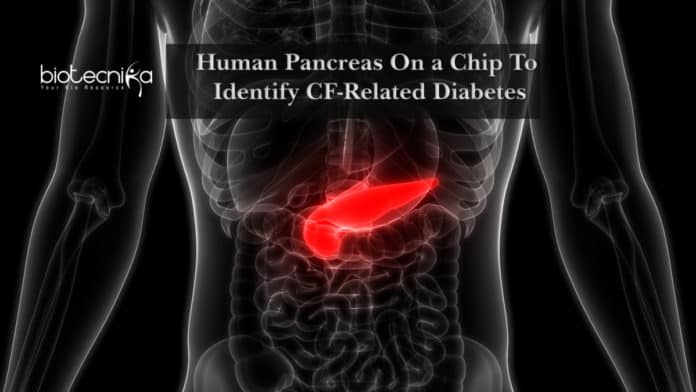 Human Pancreas On a Chip To Identify CF-Related Diabetes