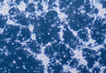 A Simple Blood Test Could Help Diagnose Glioblastoma in Future! Blood Test For Glioblastoma