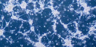 Blood Test For Glioblastoma