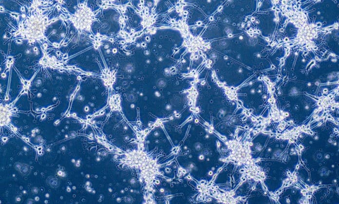 Blood Test For Glioblastoma