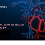 Rewiring Damaged Heart Tissues Via Carbon Nanotube Fibers Rewiring Damaged Heart Tissues Via Carbon Nanotube Fibers