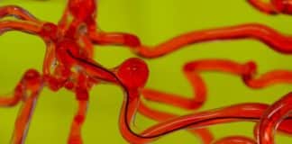 Robotic Worm for Human Brain