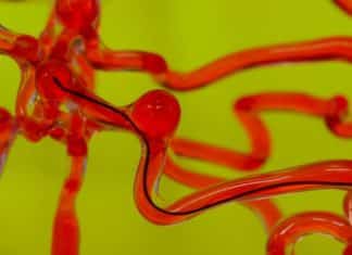 Thread-Like Robotic Worm By MIT Researchers That Burrows Into Human Brain Robotic Worm for Human Brain