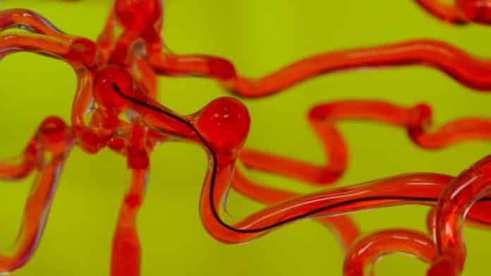 Robotic Worm for Human Brain