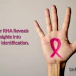 Circular RNA reveals tumor