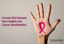 Circular RNA Reveals New Insights Into Cancer Identification & Tumor Progression Circular RNA reveals tumor