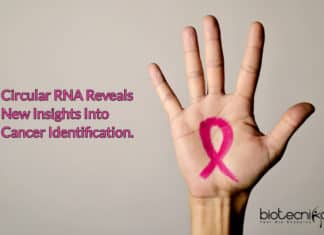 Circular RNA Reveals New Insights Into Cancer Identification & Tumor Progression Circular RNA reveals tumor