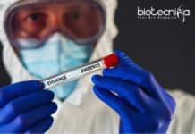 Forensic Proteomics – Novel Tool For Crime Labs & Anthropology Forensic Proteomics