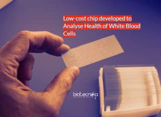 Low-Cost WBC Health Detection Chip Developed By NTU Scientists NTU Singapore scientists build chip to analyse health of white blood cells