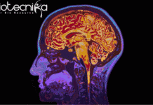MRI Technique to Detect Onset of Aging in Brain