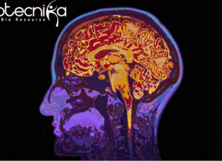 MRI Technique to Detect Onset of Aging in Brain