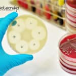 New Antibiotics from Dirt – Latest Method Designed By Scientists New Antibiotics from Dirt