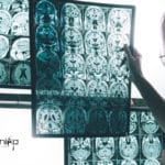 Scientists Discover New Drug For Alzheimer’s Disease New Drug for Alzheimer's Disease