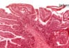 New Software for tissue Insights