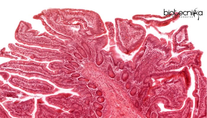 New Software for tissue Insights