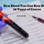 New Blood Test For Cancer