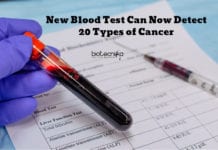 A New Blood Test Can Now Detect 20 Types of Cancer! New Blood Test For Cancer