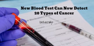 New Blood Test For Cancer