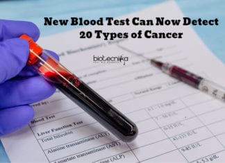 A New Blood Test Can Now Detect 20 Types of Cancer! New Blood Test For Cancer