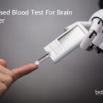 Blood Test For Brain Cancer