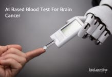 Blood Test For Brain Cancer