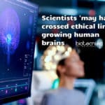 Ethical issues in brain research
