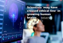 Scientists ‘May Have Crossed Ethical Line’ In Growing Human Brains Ethical issues in brain research