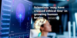Ethical issues in brain research