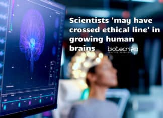 Scientists ‘May Have Crossed Ethical Line’ In Growing Human Brains Ethical issues in brain research
