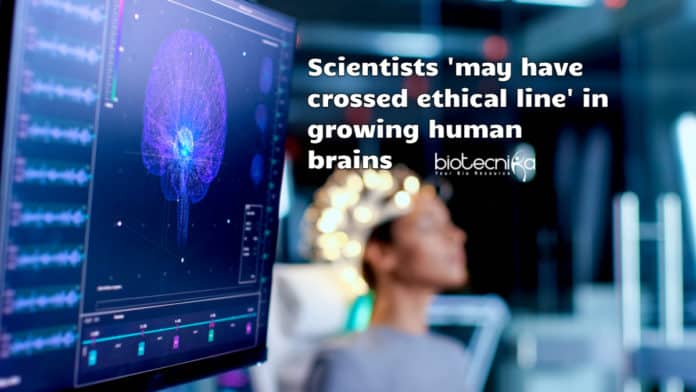 Ethical issues in brain research
