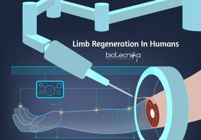 Limb Regeneration In Humans