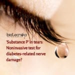 Markers in tears detect diabetes
