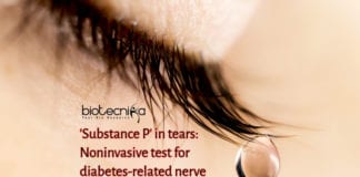 Markers in tears detect diabetes