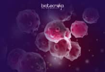 Researchers Develop Method For Separating Tissue Types In Tumor Samples Method To Separate Tumor Tissues