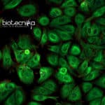 Microproteins Role In Human Disease