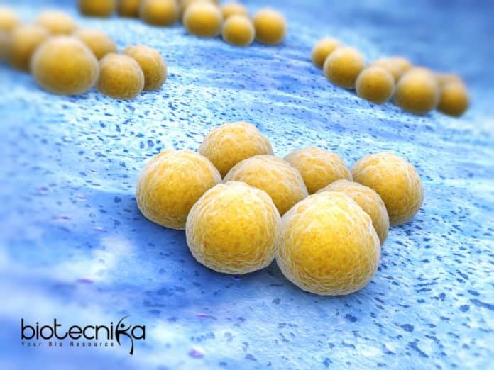 NEW ANTIBIOTIC RESISTANCE TEST