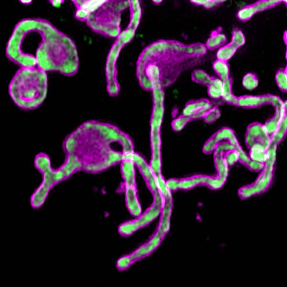 Microproteins Role In Human Disease