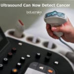 Ultrasound Spots Cancer Early
