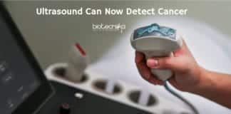 Ultrasound Spots Cancer Early
