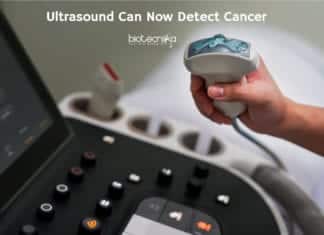 Latest Ultrasound Can Now Detect Early Cancer – Biggest Breakthrough Tech In 60 Years Ultrasound Spots Cancer Early