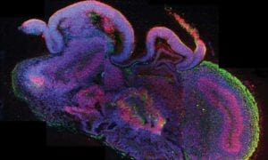 ethical issues in brain research
