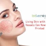 3D-Printing of Living Skin