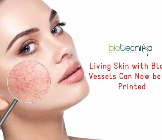 3D-Printing of Living Skin