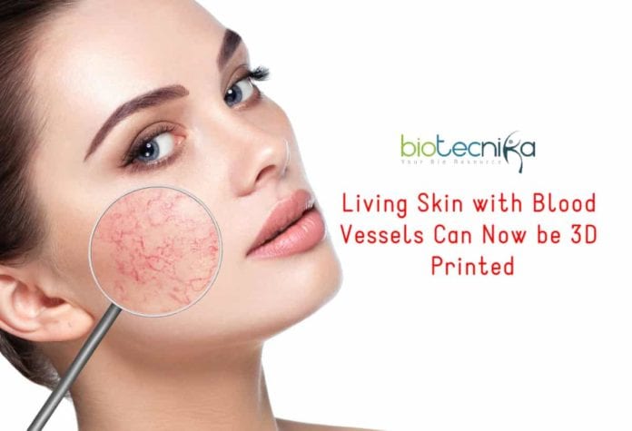 3D-Printing of Living Skin