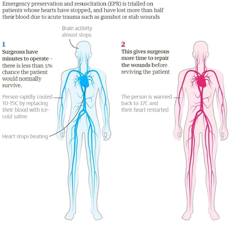 Humans Put Into Suspended Animation