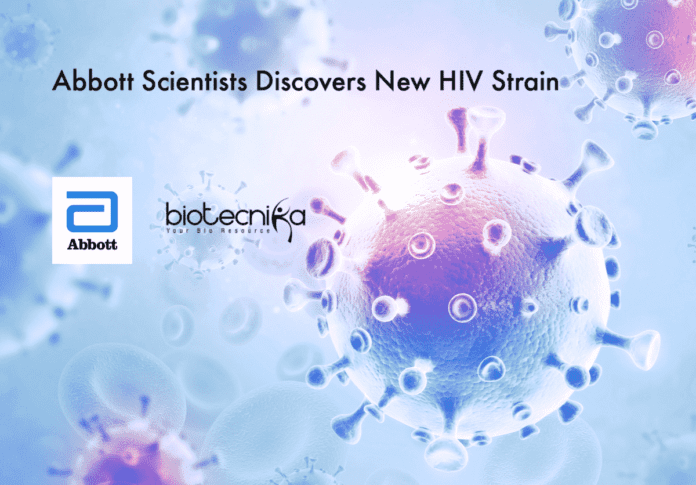 Abbott Discovers New HIV Strain