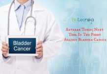 Anthrax Could Offer Next Frontier Of Bladder Cancer Treatment Anthrax-toxin to kill bladder cancer